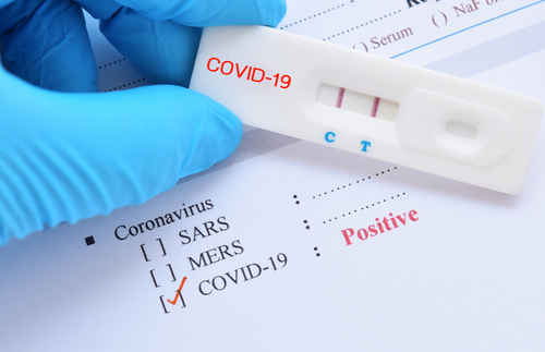 Positive Covid-19 test result