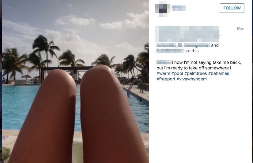 Instagram fail: Hot dog legs