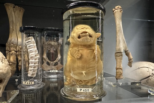 London's Hunterian Museum: Bits of People in Jars That Changed the World | Frommer's